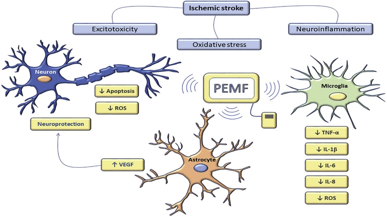 Neurological Effects of Magnet Therapy in Physiotherapy