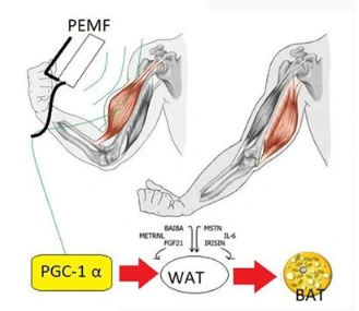 مگنت تراپی در لاغری